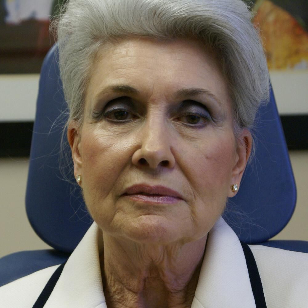 Facelift And Neck Lift Before & After