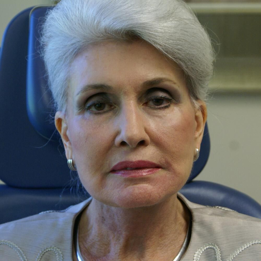 Facelift And Neck Lift Before & After