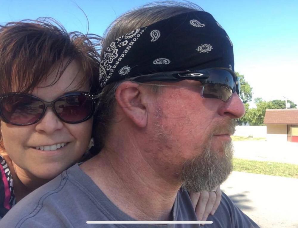 Rhinophyma Reduction Before & After