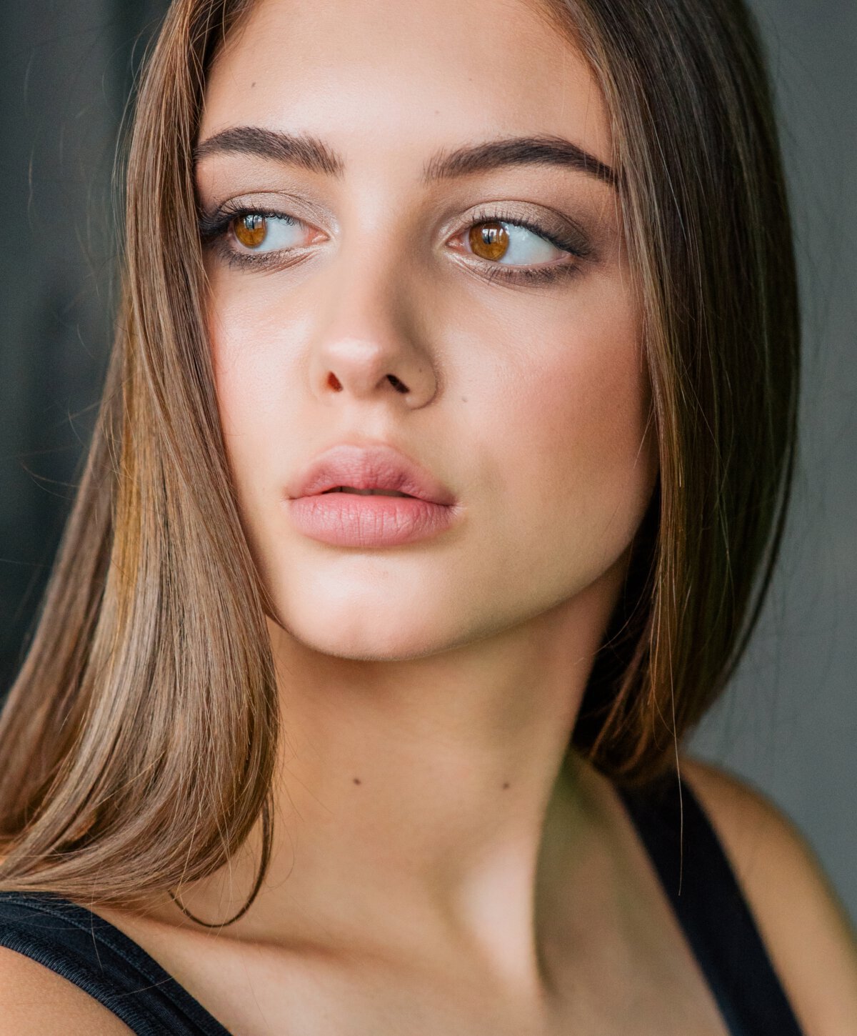 St. Louis Juvederm model in a black top